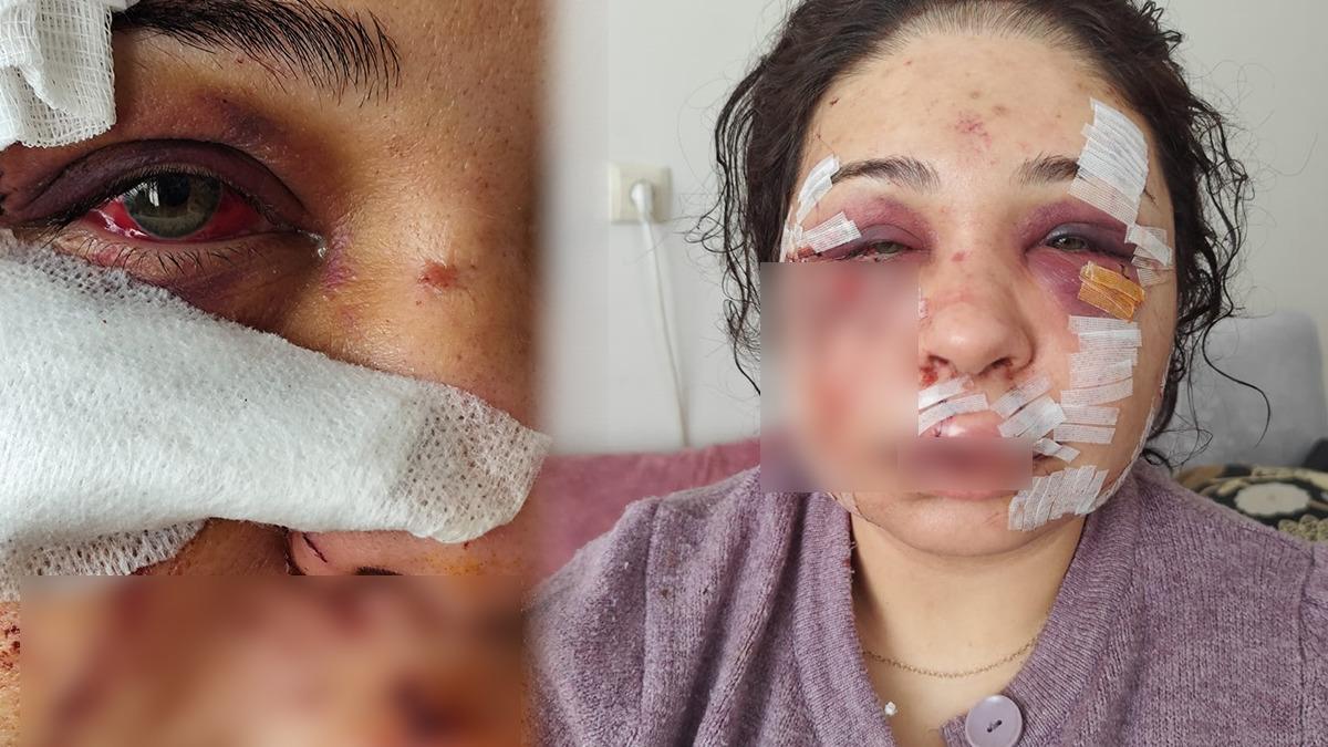 Polis Eşini Yıktı